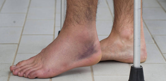 6 Best Lateral Ankle Sprain Exercises for a Fast Recovery